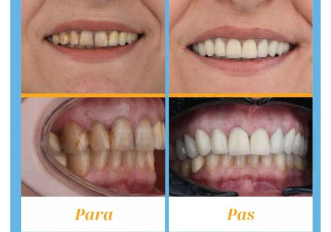 klinike dentare tirane Klinike dentare dhe laborator ofron sherbime si stomatologji,trajtim endodontik,